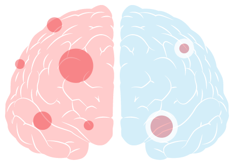 Solution brain